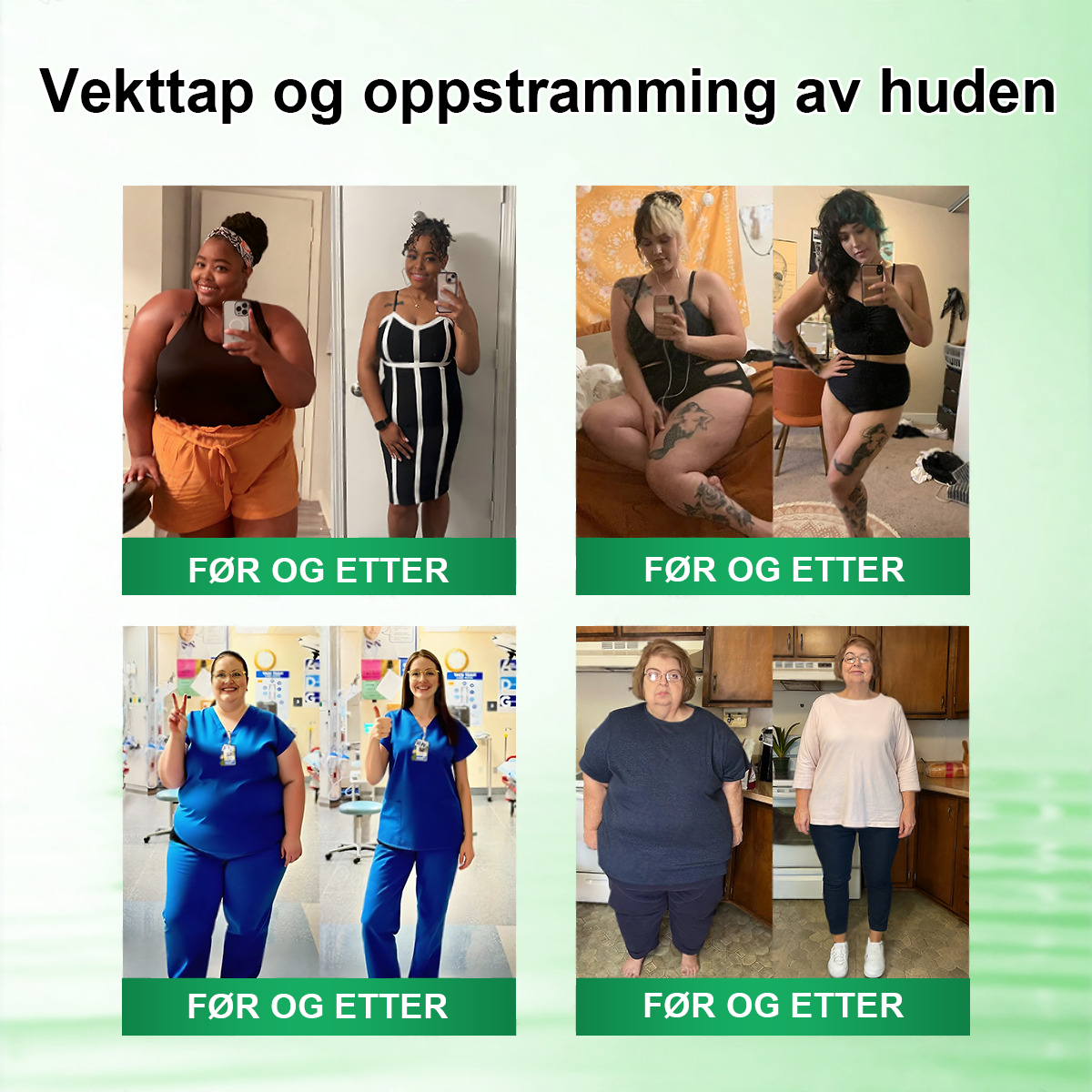 Begrenset til 10 esker 🌟 Careuplift® — eksklusiv 30 % rabatt, nå dine vekttapsmål! En sjelden mulighet — vil ikke være tilgjengelig igjen før neste år, ikke gå glipp av det! 180 dagers pengene-tilbake-garanti, full refusjon uten risiko!