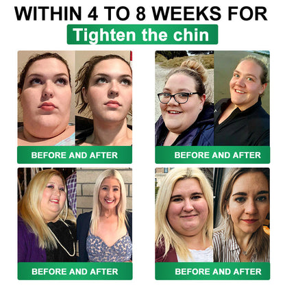 𝑶𝒇𝒇𝒊𝒄𝒊𝒂𝒍 𝑺𝒕𝒐𝒓𝒆  | 💯💯𝐂𝐚𝐫𝐞𝐔𝐩𝐥𝐢𝐟𝐭®𝑴𝒐𝒓𝒊𝒏𝒈𝗮 · 𝗕𝗲𝗿𝗯𝗲𝗿𝙞𝙣𝙚 × 𝙉𝘼𝐃+ 𝟏𝟎-𝐢𝐧-𝟏 𝗔𝗱𝘃𝗮𝗻𝗰𝙚𝙙 𝙉𝙖𝙣𝙤 𝙈𝙞𝙘𝙧𝙤𝙣𝙚𝙚𝐝𝐥𝐞 𝐏𝐚𝐭𝙘𝙝🇬🇧(𝐉𝐮𝐬𝐭 𝐨𝐧𝐜𝐞 𝐚 𝐝𝐚𝐲, 𝐯𝐢𝐬𝐢𝐛𝐥𝐞 𝐜𝐡𝐚𝐧𝐠𝐞𝐬 𝐢𝐧 𝟕 𝐝𝐚𝐲𝐬） ✅ 𝐅𝐨𝐫 𝐨𝐛𝐞𝐬𝐢𝐭𝐲, 🅛🅞🅞🅢🅔 🅢🅚🅘🅝,𝐝𝐢𝐚𝐛𝐞𝐭𝐞𝐬, 𝐬𝐥𝐞𝐞𝐩 𝐚𝐩𝐧𝐞𝐚, 𝐣𝐨𝐢𝐧𝐭 𝐢𝐬𝐬𝐮𝐞𝐬, 𝐚𝐧𝐝 𝐦𝐨𝐫𝐞💯💯